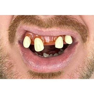 Billy Bob Teeth | Tiger Man Teeth